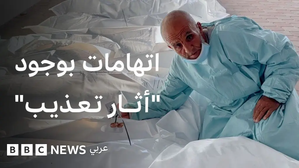 اتهامات بوجود "أثار تعذيب" على جثامين فلسطينيين سلمتها إسرائيل إلى غزة