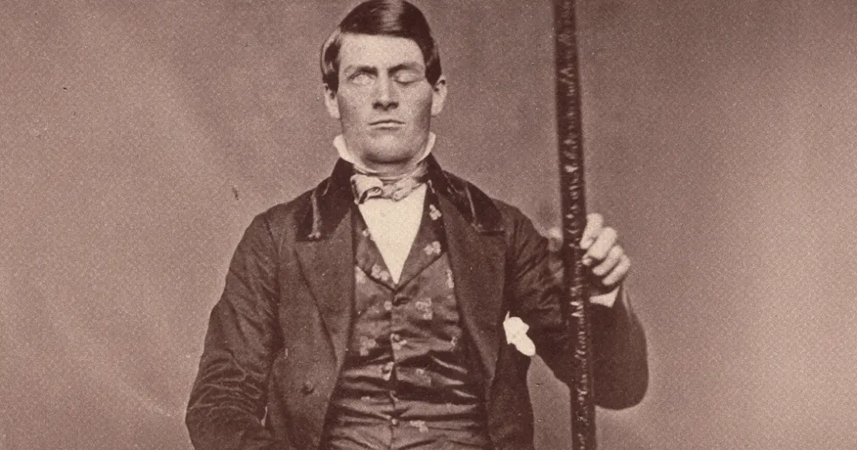 “فينياس غيج”.. شاب اخترق قضيب حديد جمجمته فألهم علماء جراحة الدماغ