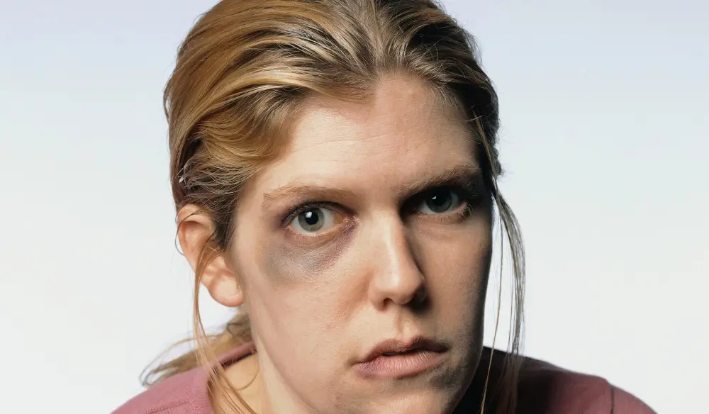 في أقبية الأسد .. اغتصبها الشبيحة ونبذها المجتمع لتحاول الإنتحار 3 مرات