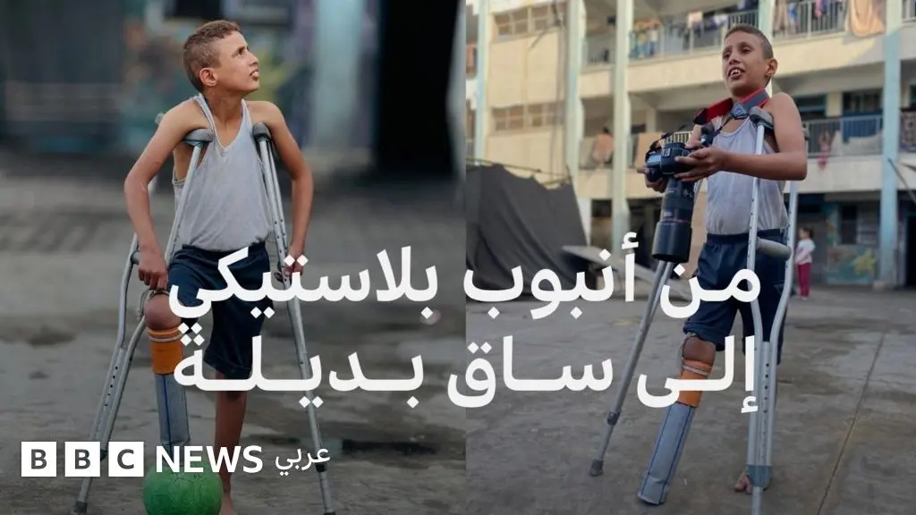 قصة طفل غزي فقد ساقه في غارة إسرائيلية