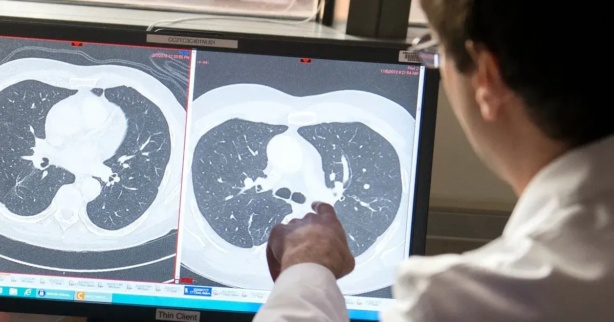 العلاج بالأشعة تحت الحمراء.. هل يدمّر الخلايا السرطانية؟