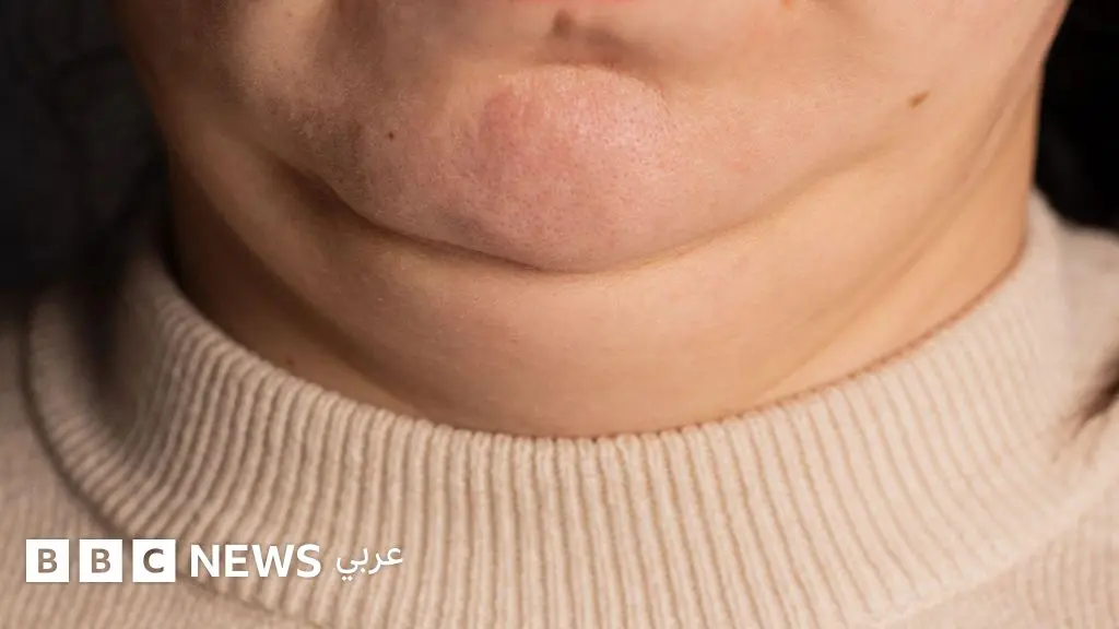 الصحة: ما الذي يكشفه حجم رقبتك عن صحتك؟