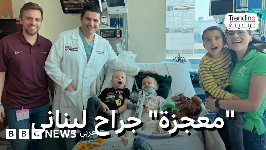في "سابقة طبية" .. الطبيب اللبناني محمد بيضون يعيد وصل رأس طفل بجسده