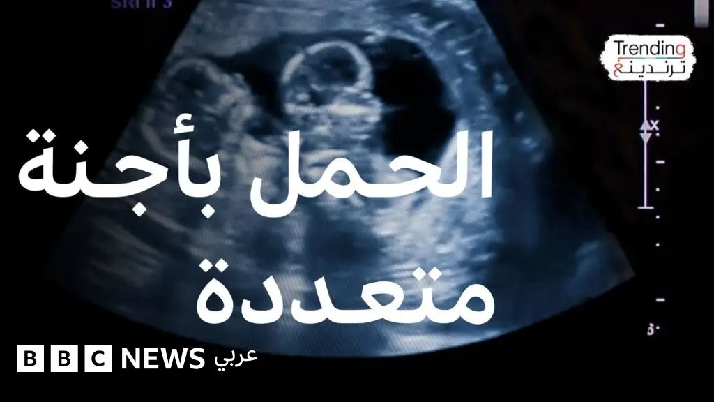 الحمل بأجنة متعددة.. ما مخاطره وما طرق علاجه؟