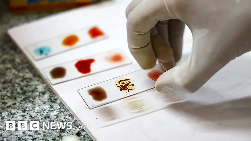 "الدم الذهبي": تعرّف على سحر فصيلة الدم الأندر في العالم