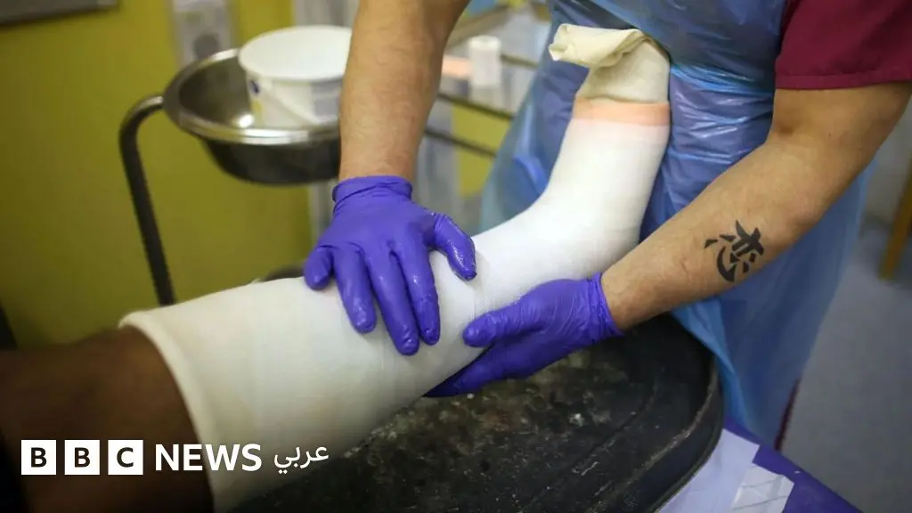 الذكاء الاصطناعي يساعد الأطباء في العثور على الكسور وعلاجها