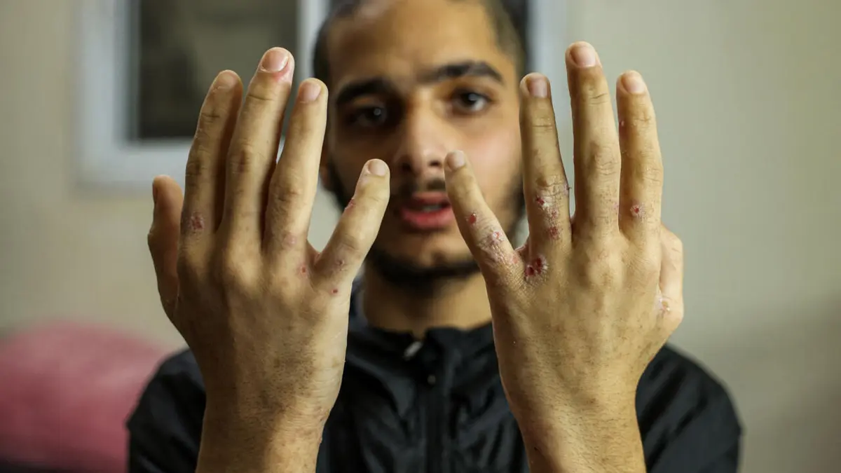 تقرير حقوقي: وفاة 98 فلسطينيا في مراكز احتجاز إسرائيلية منذ حرب غزة