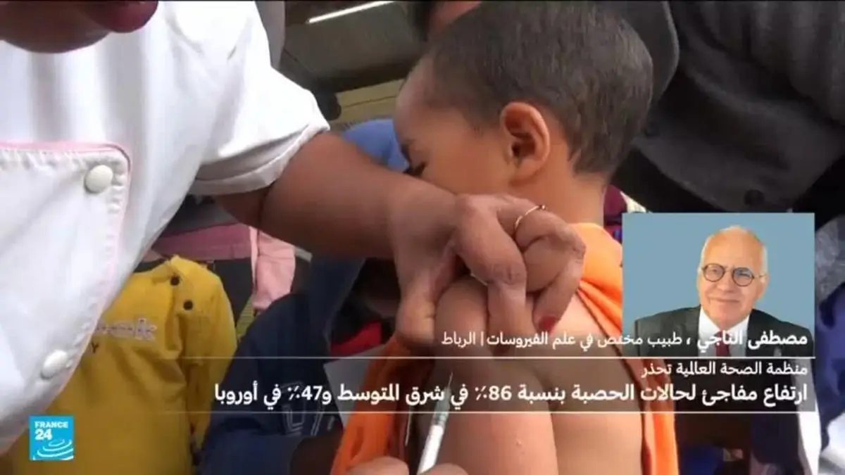منظمة الصحة: ارتفاع مفاجىء للحصبة في شرق المتوسط وأوروبا