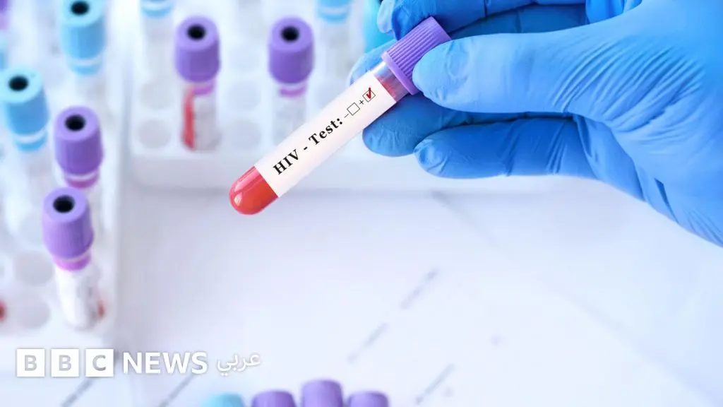 الإيدز: كيف تزيد أعداد المتعايشين في المنطقة على عكس العالم؟