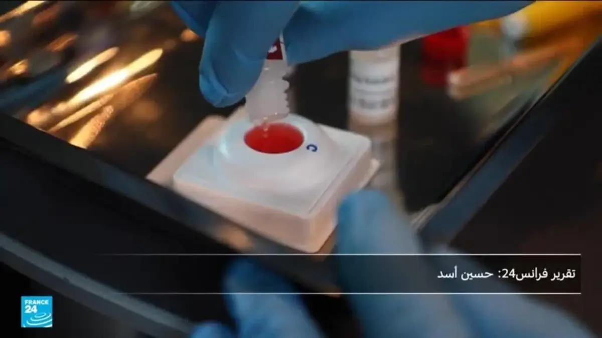 عزلة وتهميش.. معاناة صامتة لمرضى الإيدز في بروكسل