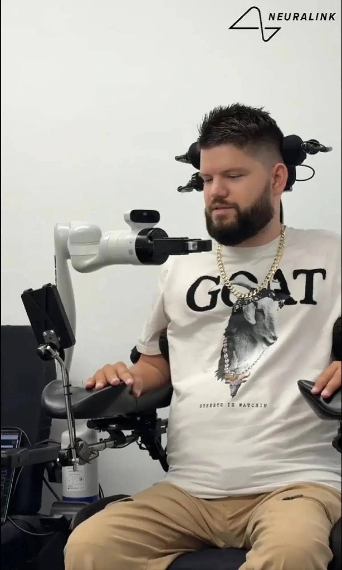 شريحة دماغية تُمكّن المرضى من تحريك أطراف روبوتية بمجرد التفكير