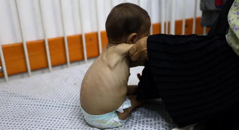 اليونيسف: أطفال غزة يحملون آثار الحرب حتى قبل أن يفتحوا أعينهم على العالم