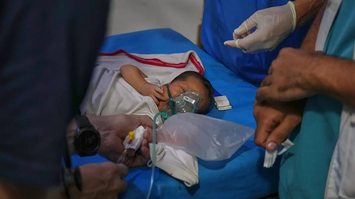 فيديو - رغم وقف إطلاق النار.. تزايد حالات تشوه الأجنة والمواليد في قطاع غزة