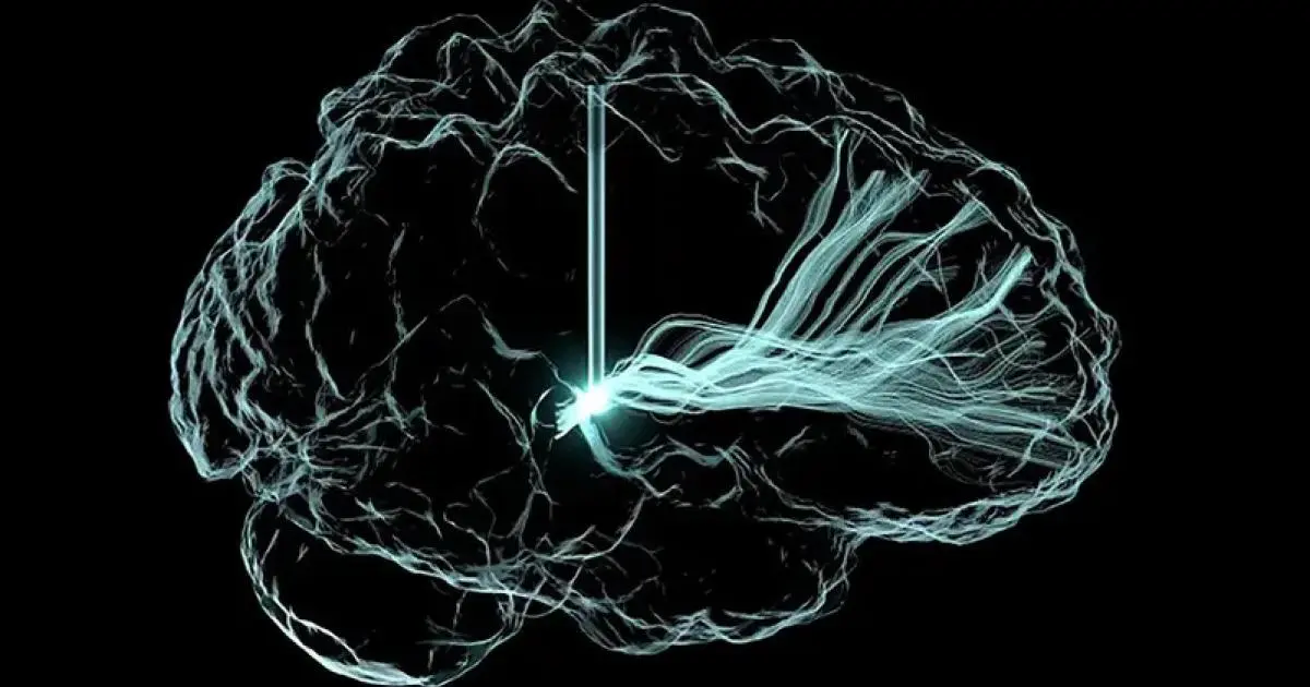 تقنية صينية تعيد التفاعل لمصاب بشلل كامل عبر إشارات الدماغ