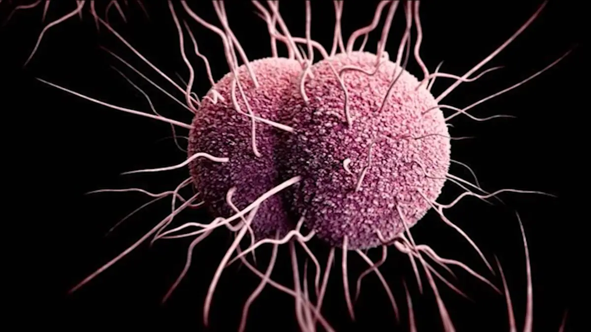 مع تزايد مقاومة المضادات الحيوية.. علاجان جديدان وعمليان للسيلان