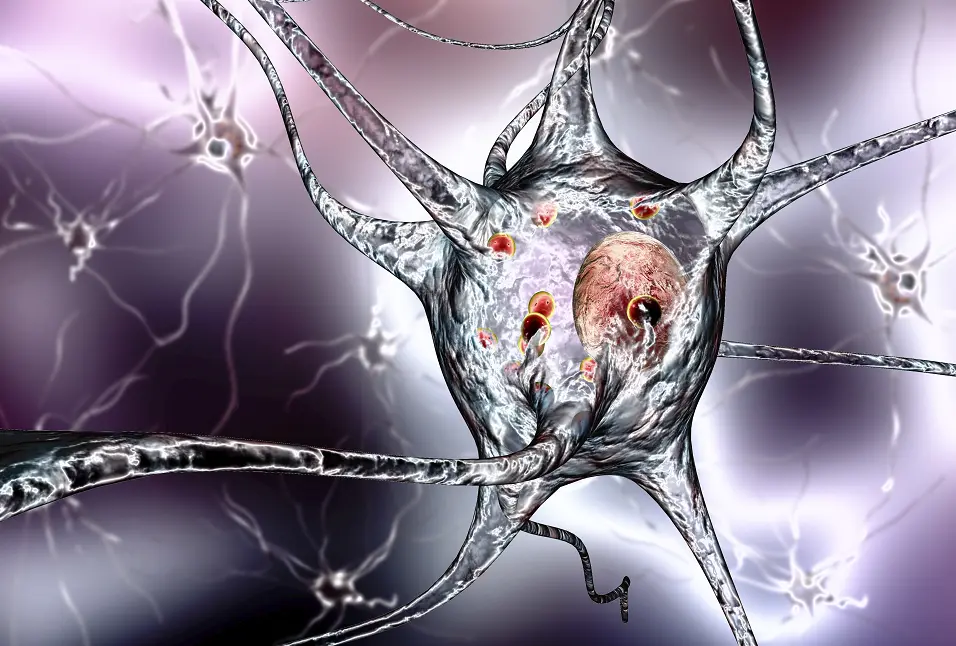 دواء شائع للهربس قد يفاقم ألزهايمر المبكر