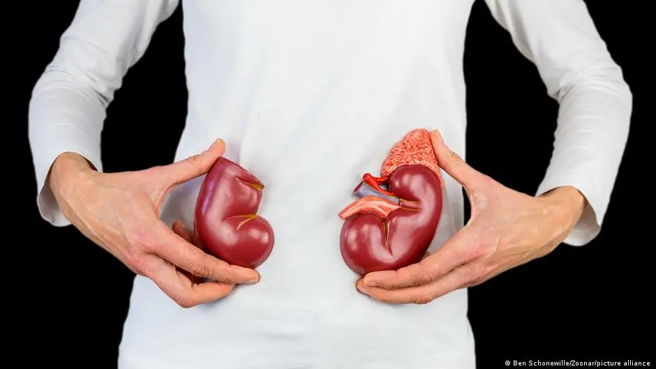 دلّل كليتك بهذه الأطعمة وجنبها هذه المرهقات! – DW – 2025/12/23