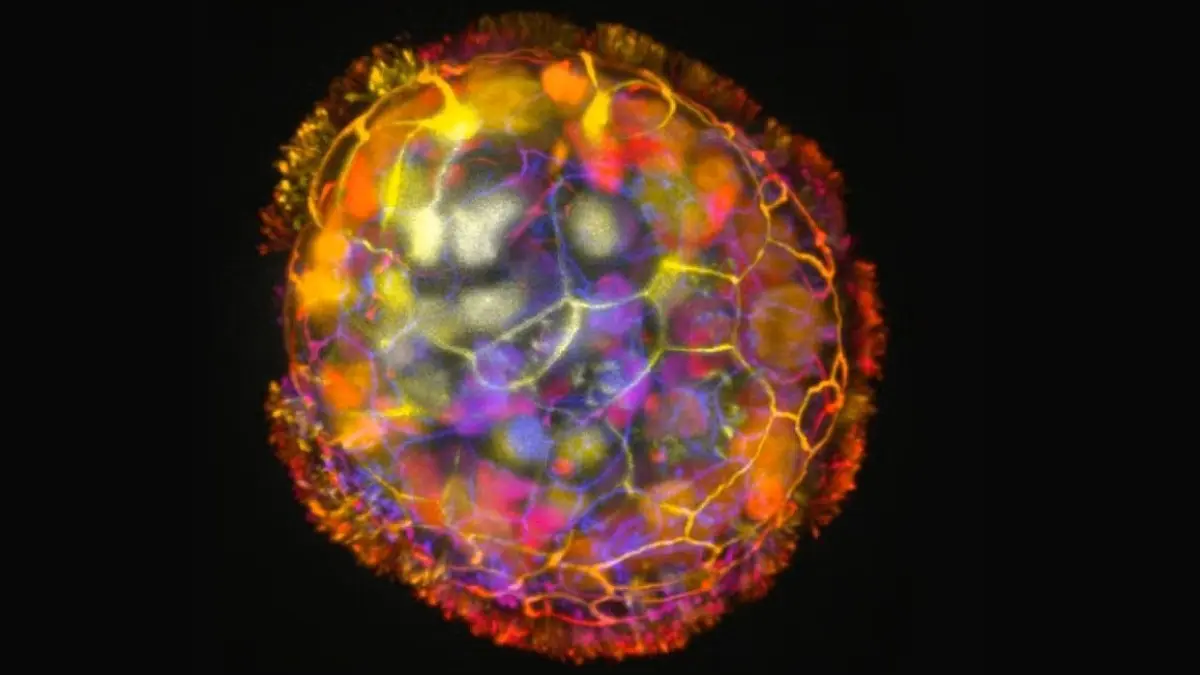 كيف يتم تنسيق تكون البروتين في الخلايا؟