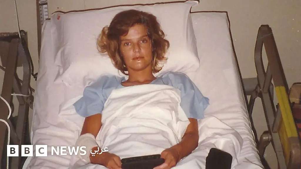 ناجية وحيدة من تحطم طائرة تروي كيف بقيت على قيد الحياة ثمانية أيام في الأدغال - BBC News عربي