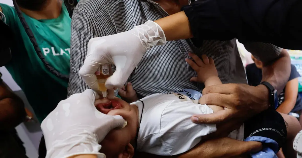 الحرب والمجاعة تزيدان التشوهات الخلقية والولادات المبكرة في غزة