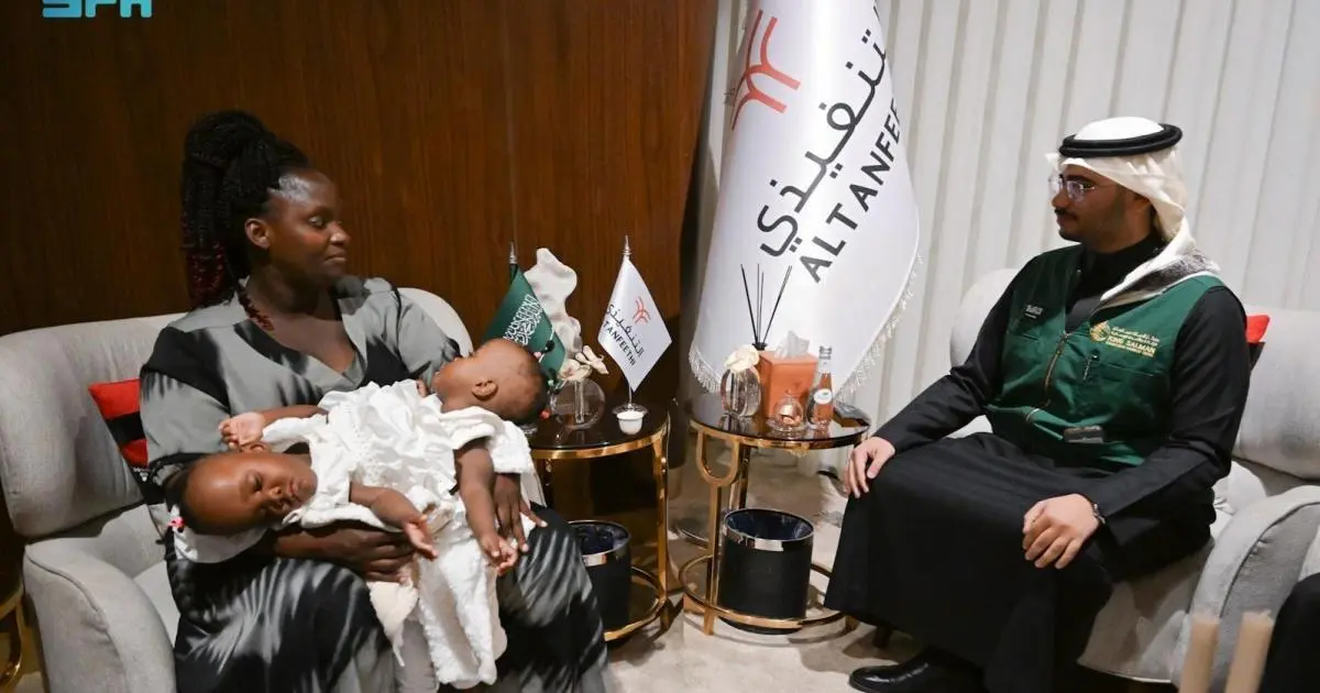 وصول توأم تنزاني ملتصق إلى السعودية تمهيداً لفصلهما