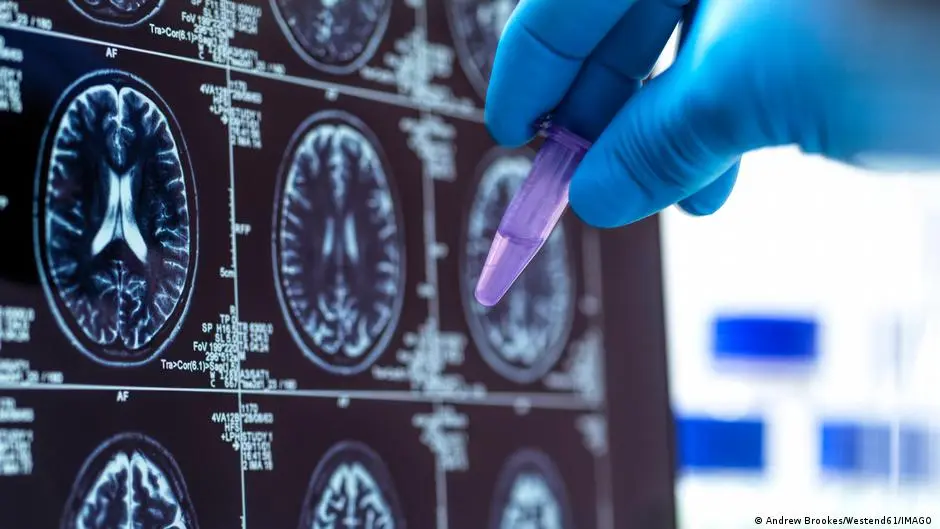 بروتينات حساسة مغناطيسيًا قد تحدث ثورة في عالم التصوير الطبي