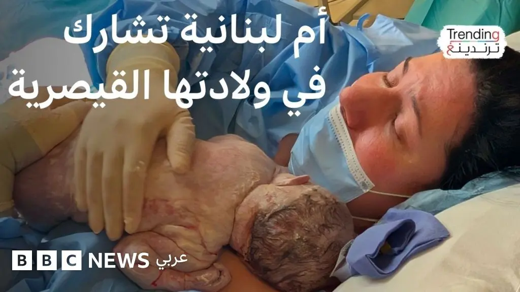 لبنانية تخرج طفلتها من رحمها في عملية قيصرية بإسكتلندا.. فماذا قالت عن التجربة؟ - BBC News عربي