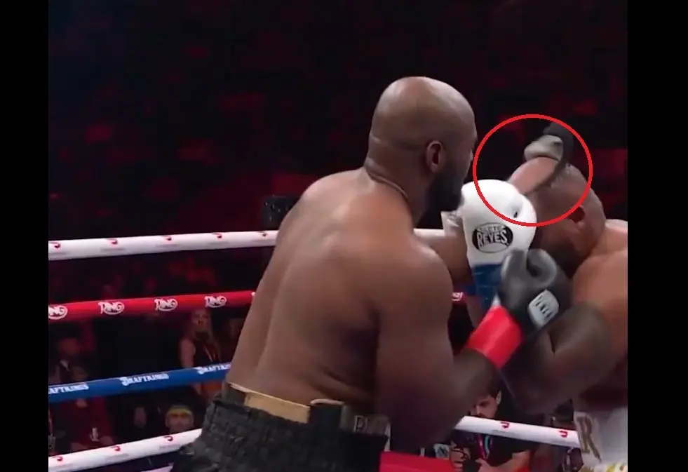 "نزع شعره المستعار".. لحظة محرجة و"طريفة" لملاكم على الحلبة (فيديو)