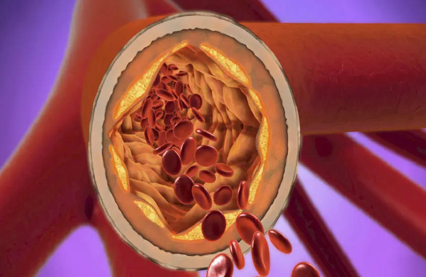 اكتشاف بروتين جديد ينظّم الكوليسترول ويفتح آفاقاً لعلاجات أدق لأمراض القلب