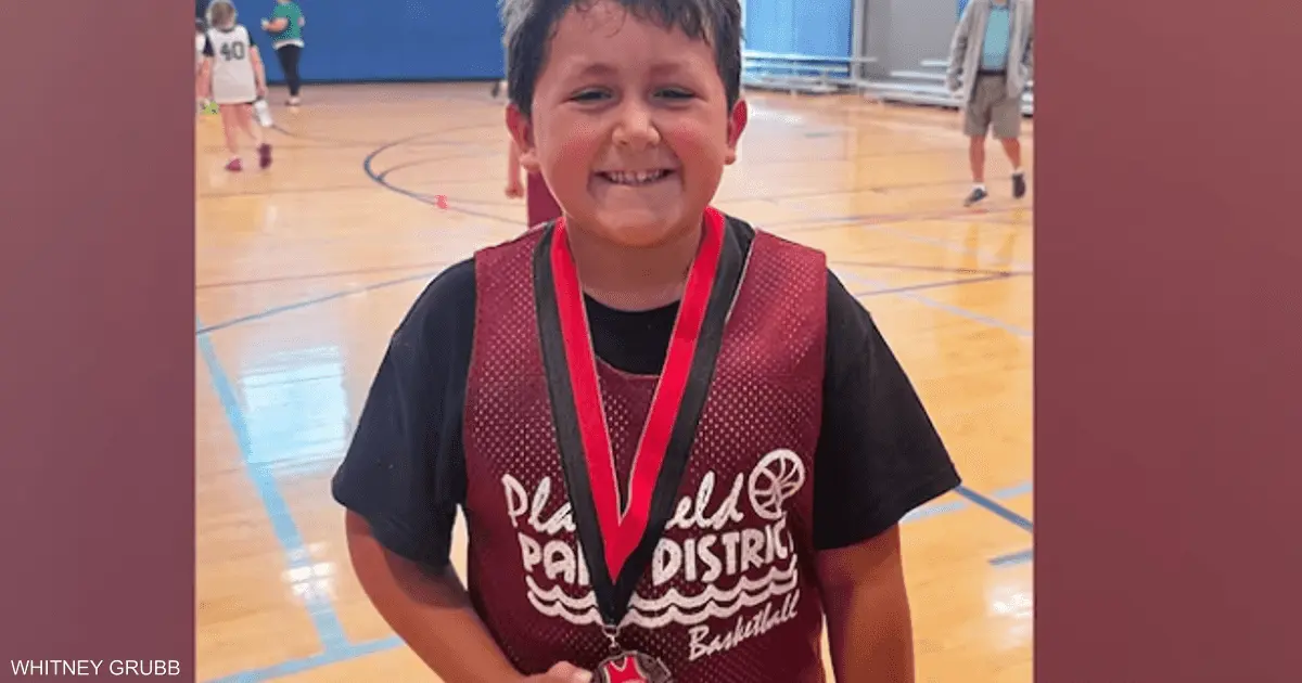 نفذ تحديا على تيك توك.. لعبة تنفجر في وجه طفل وتصيبه بحروق