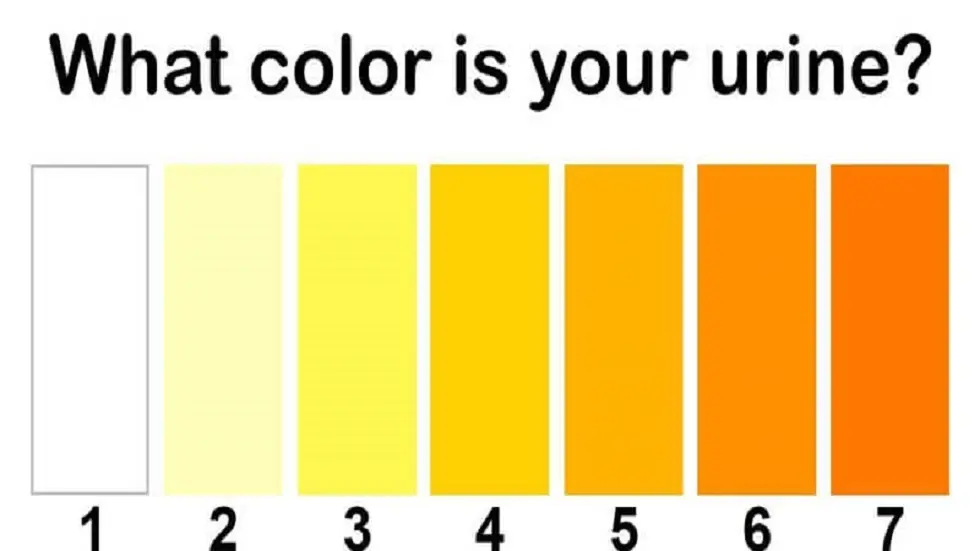 لون البول إلى ماذا يشير؟