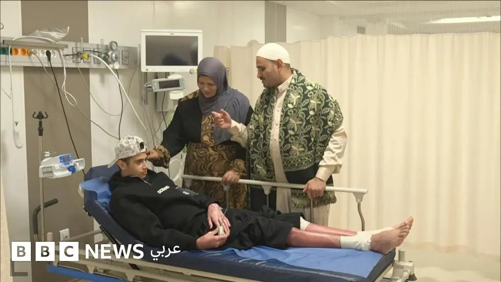 زراعة الجلد البشري: طوق نجاة لمصابي الحروق في مصر - BBC News عربي