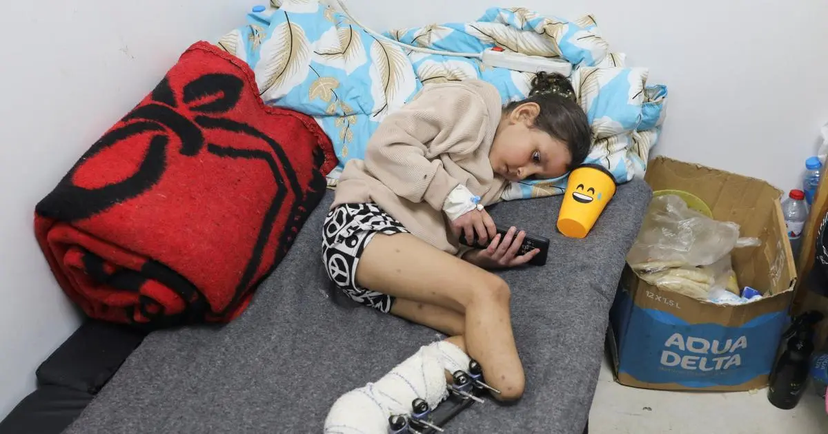 حملة إماراتية لتأهيل ألف طفل مبتور الأطراف في غزة