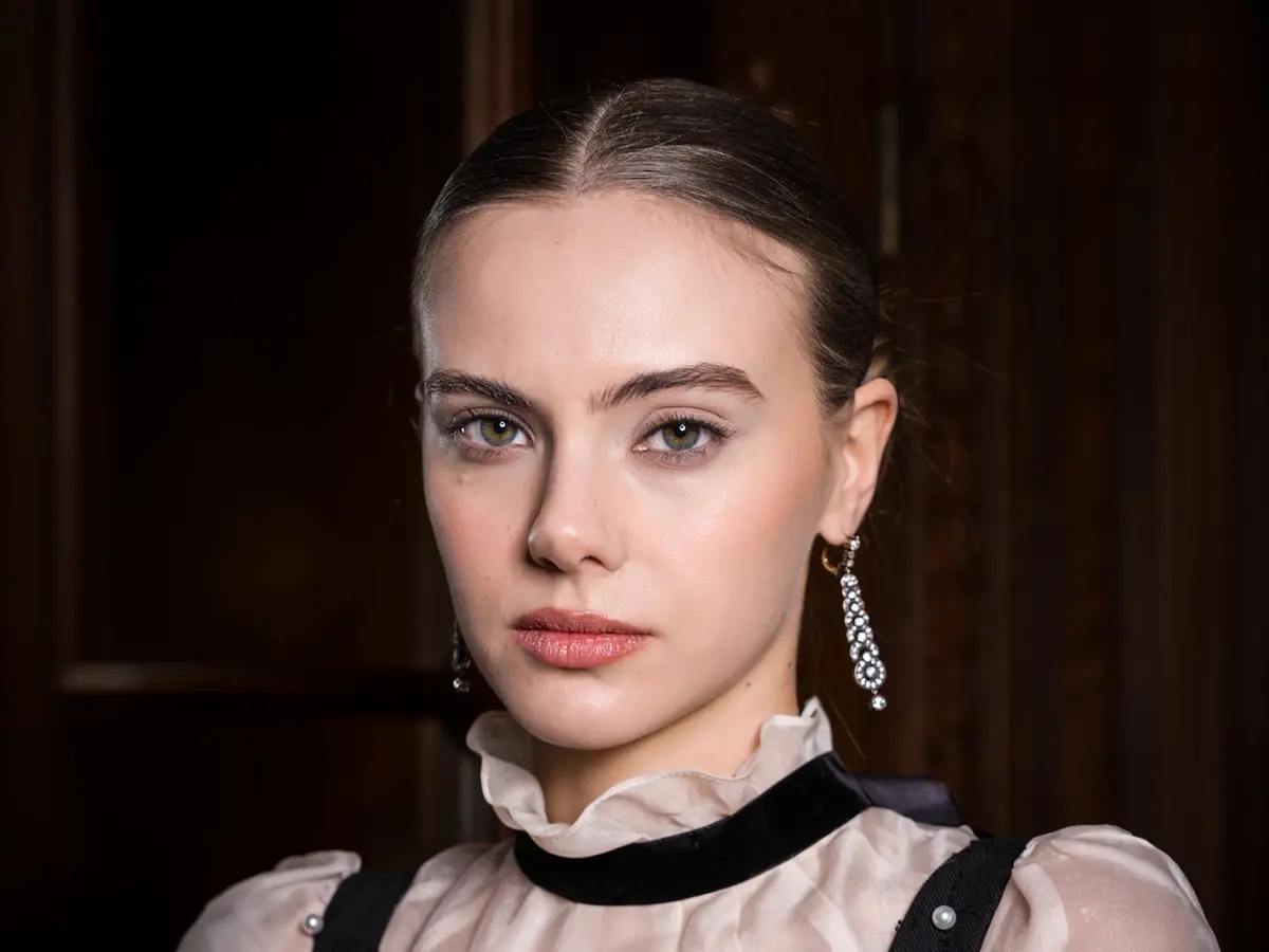 تجربتي مع الفيلر تحت العين ... من القلق إلى النتيجة التي فاقت توقعاتي