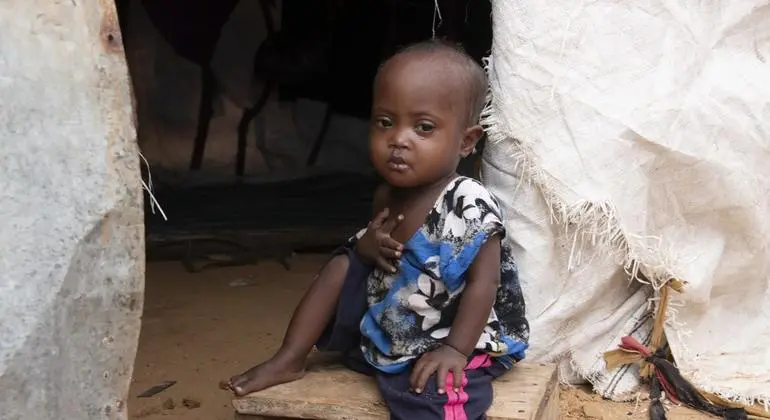 الصومال - الجوع الحاد يعصف بـ 6.5 مليون شخص