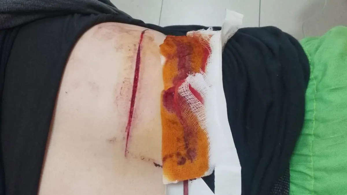 شاهد عيان: تعرض عامل وطن لاعتداء أثناء عمله في عمان