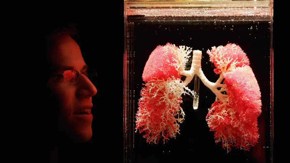 أعراض الجلطة الرئوية..هذه فئة الأشخاص الأكثر عرضة للإصابة بها