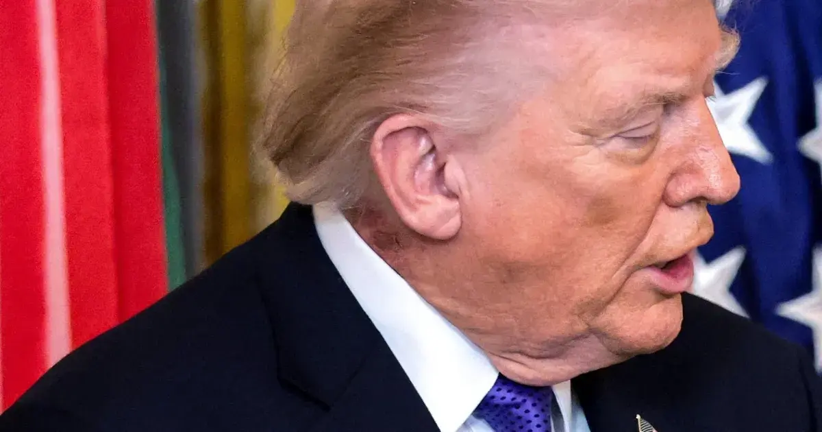 "طفح جلدي" على رقبة ترمب.. البيت الأبيض يوضح السبب