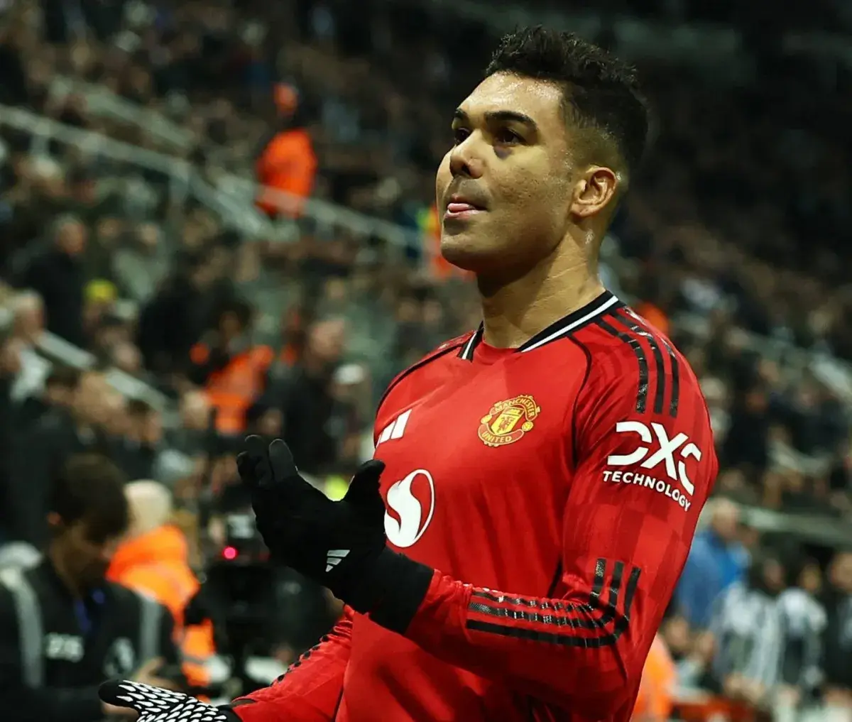 الكشف عن سر ندبة كاسيميرو أمام نيوكاسل