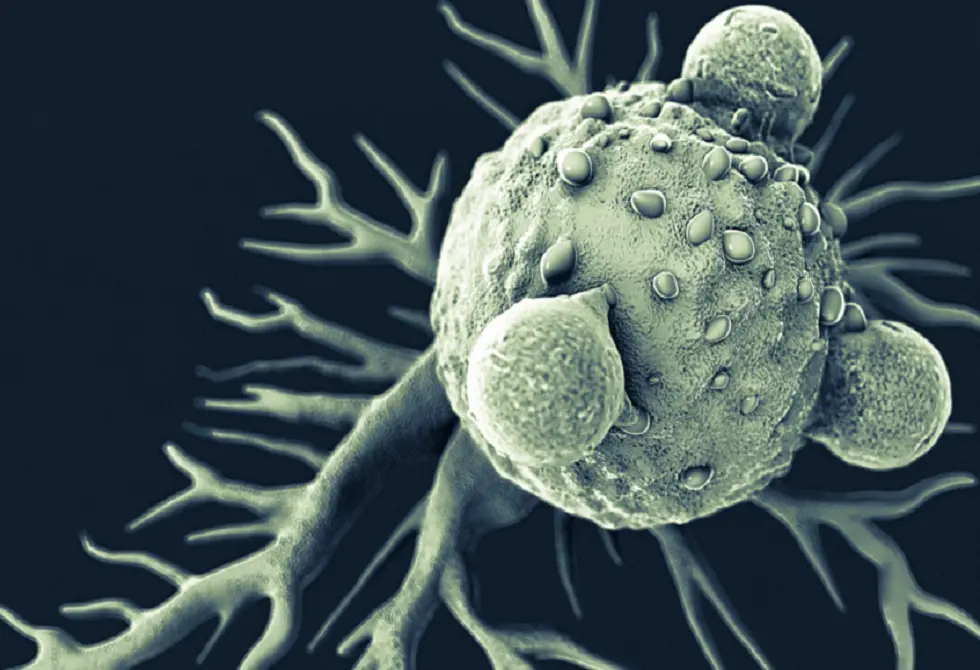 "إشارة إنذار مبكر" لسرطان البنكرياس قد تنقذ آلاف الأرواح