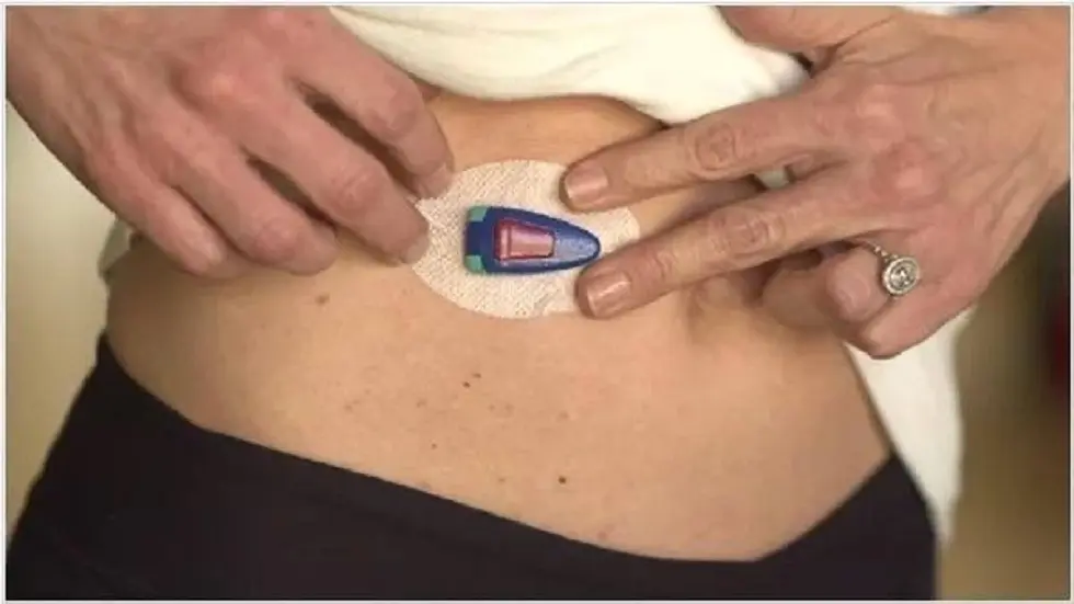 جهاز روسي مبتكر لقياس مستوى السكر في الدم دون الحاجة لوخز الجلد