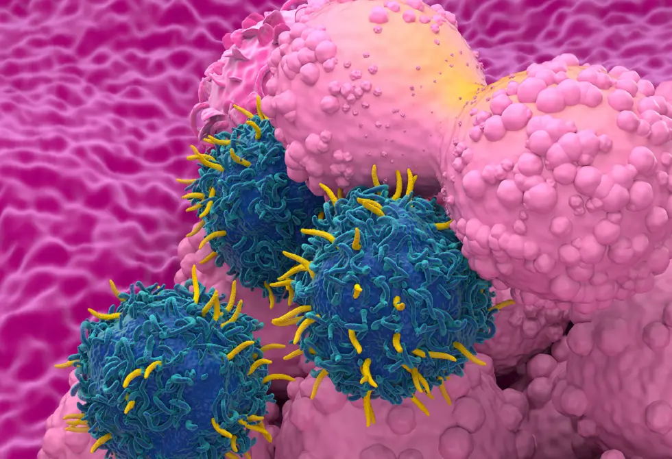 علاج لسرطان الثدي يقي المريضات من أثر جانبي مرهق ومثير للقلق