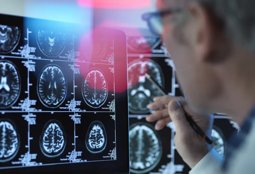 حالة صحية شائعة قد ترتبط بزيادة خطر الخرف