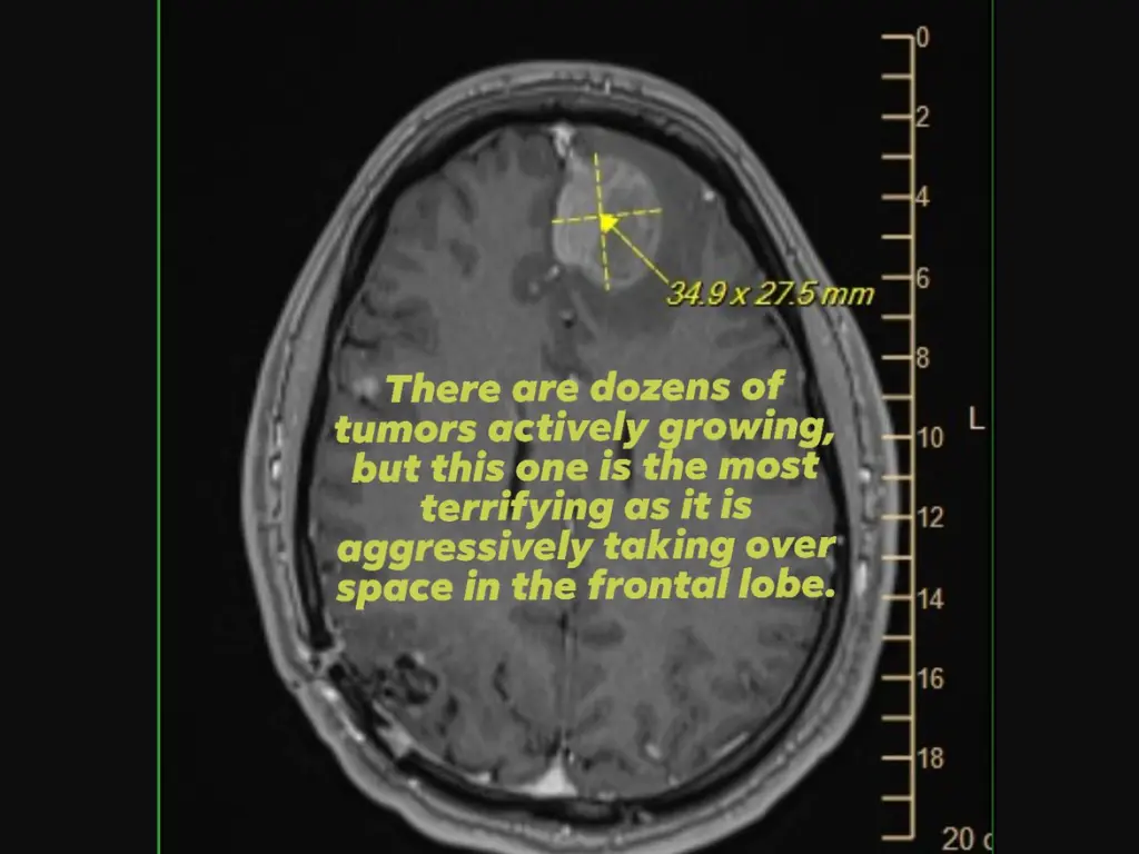 إقالة موظفين في Epic Games بعد وفاة مطور مصاب بسرطان الدماغ