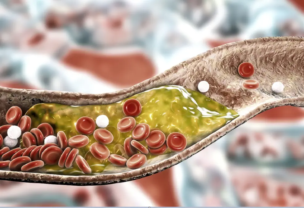 سرّ بسيط لصحة القلب.. أطعمة تخفض الكوليسترول خلال أسابيع